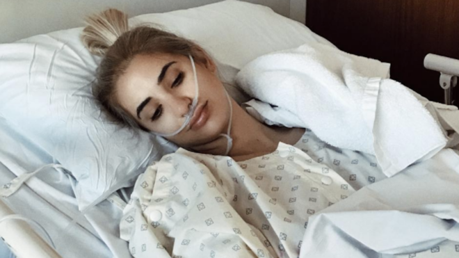 woman with endometriosis