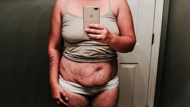 Mom's postpartum body