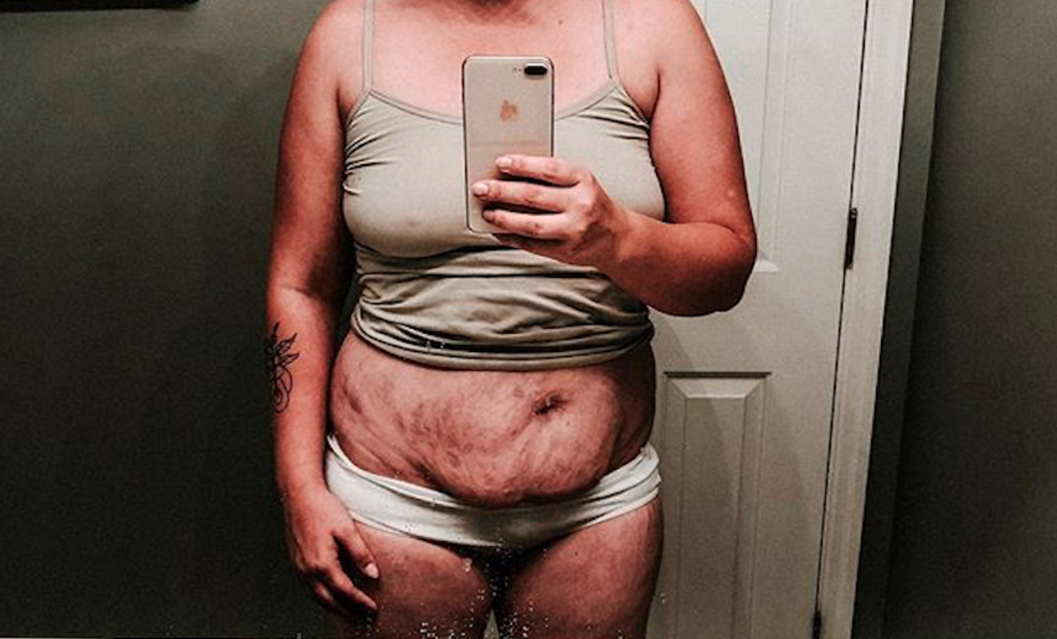Mom's postpartum body