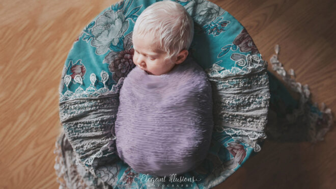 Newborn with albinism