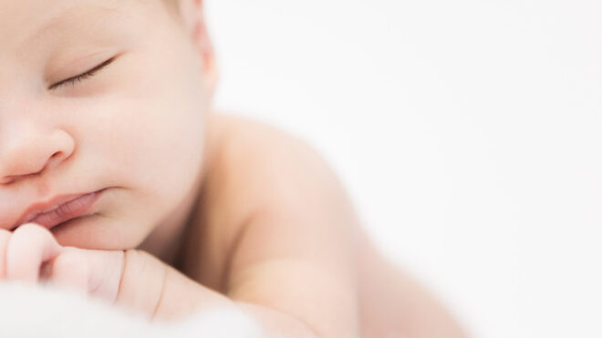 newborn acne