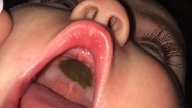 A close-up on the inside of Bella Depreta's mouth