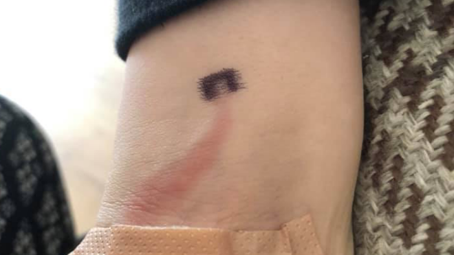Close-up on Alexandra Ruddy's son's wrist