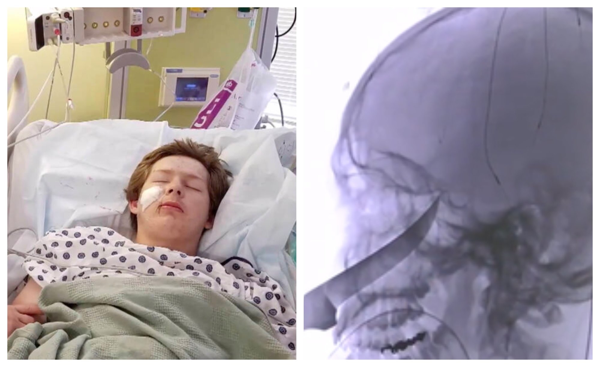 Eli Gregg in the hospital