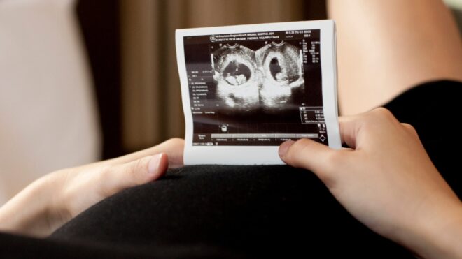 Pregnancy sonogram