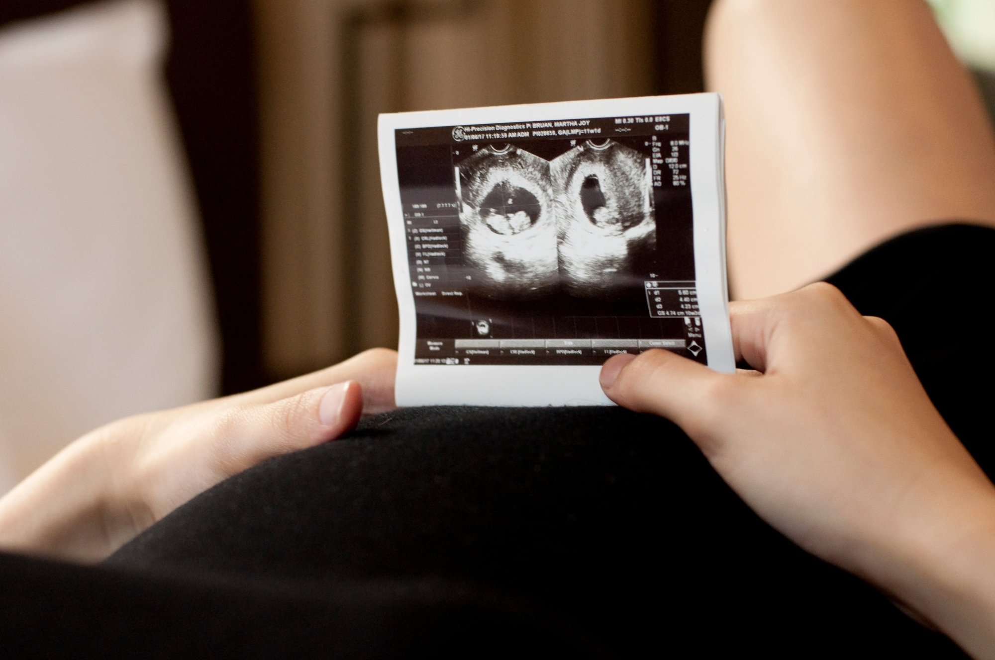 Pregnancy sonogram