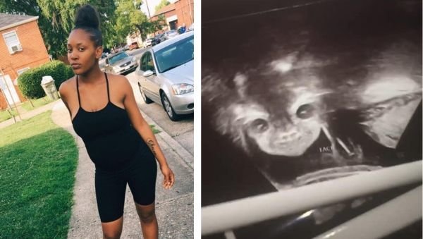 devil baby sonogram