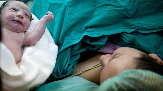 Mother looks at child after C-section