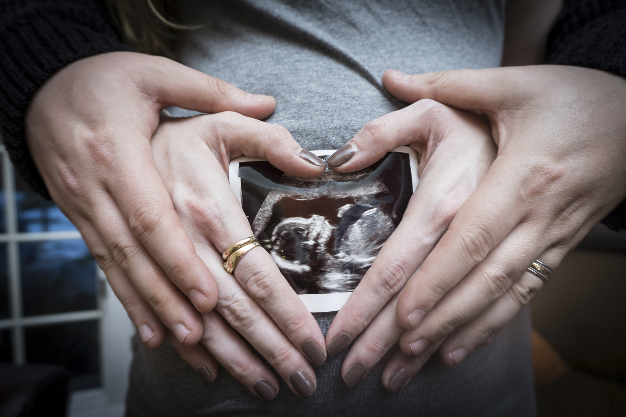 pregnancy