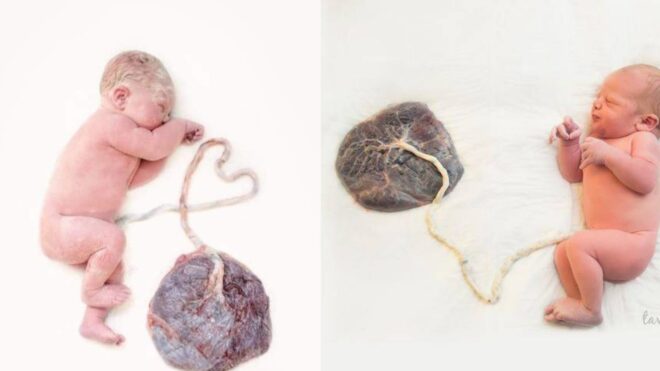 placenta and newborn
