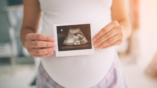 Woman holds up sonogram