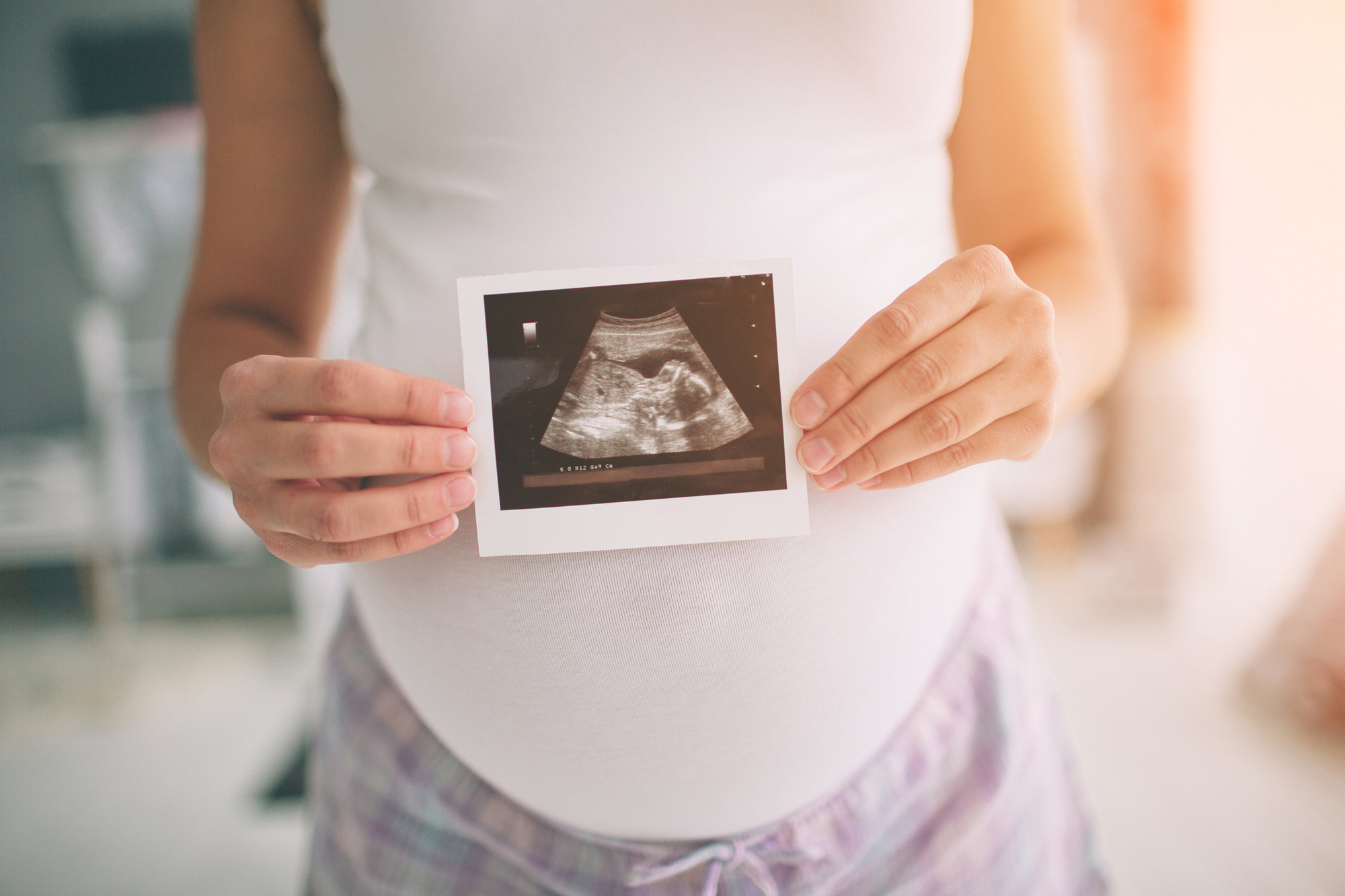 Woman holds up sonogram