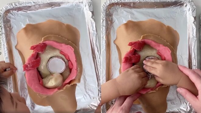 Jessica So performs Play-Doh surgery with son