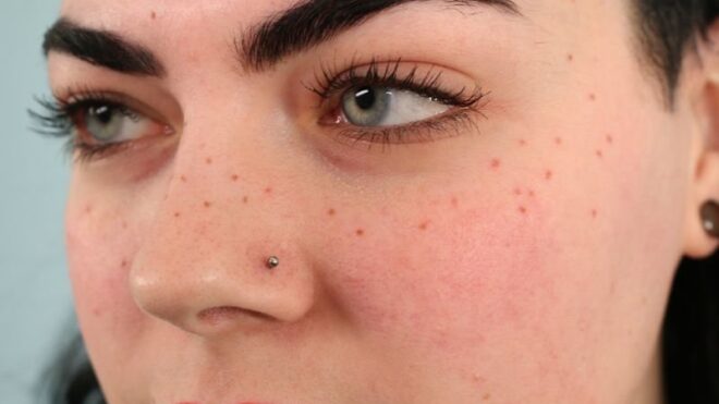 fake freckles