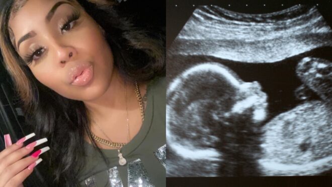 Fetus