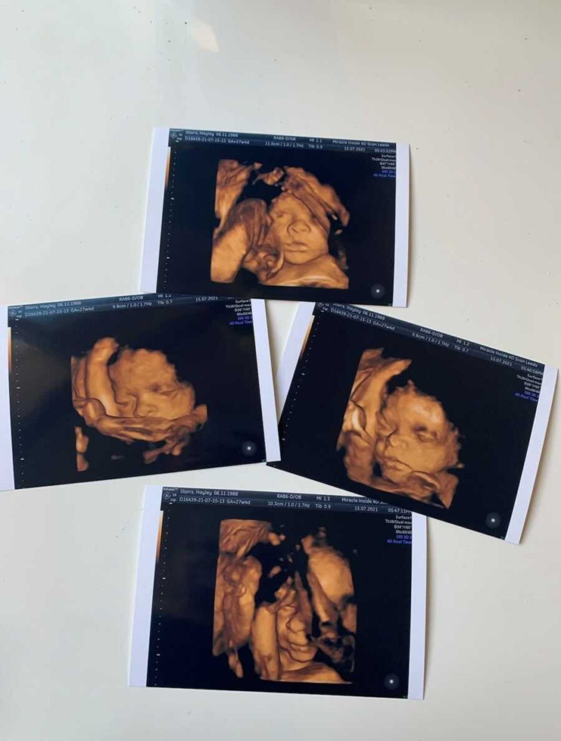 hayley_storrs_stillborn10-900x1189-1.jpg