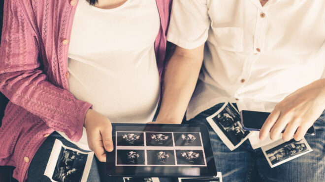 couple looks at sonogram