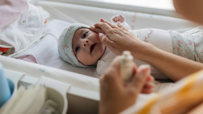 baby with cradle cap