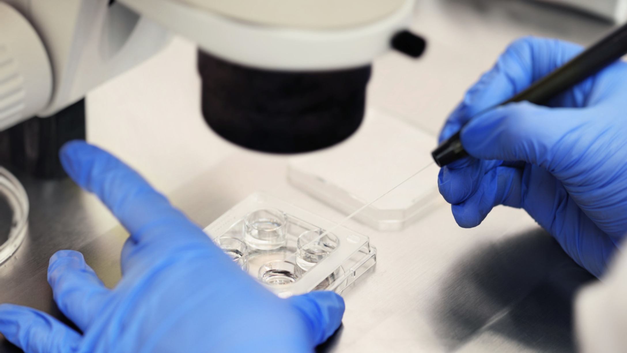 IVF in-vitro