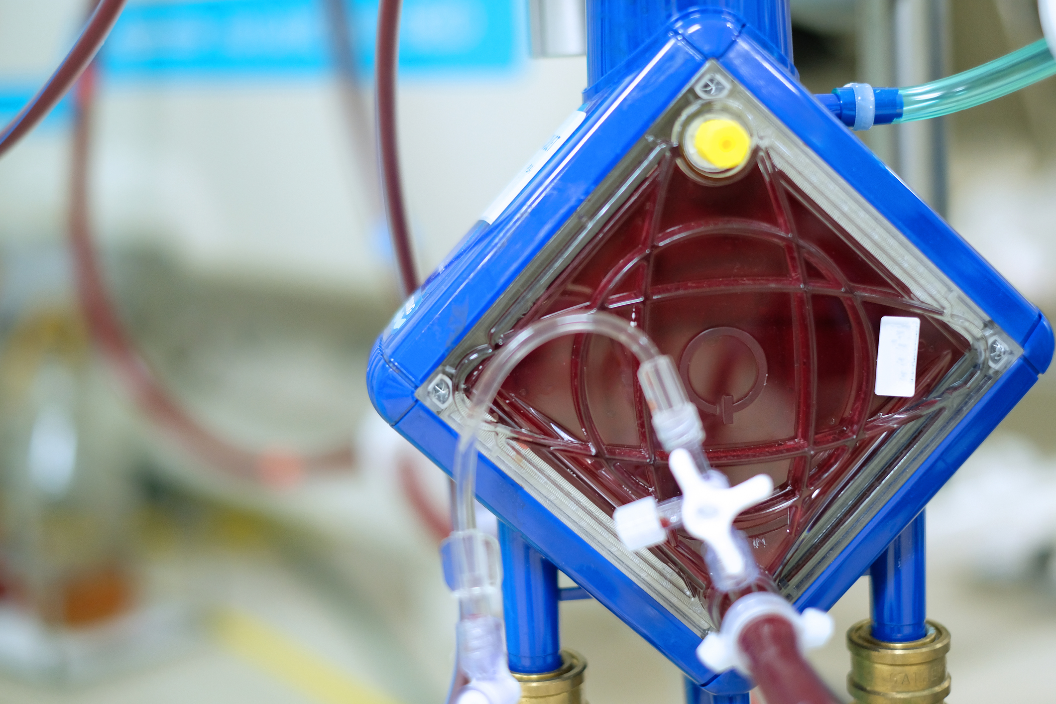 Extracorporeal membrane oxygenation (ECMO)