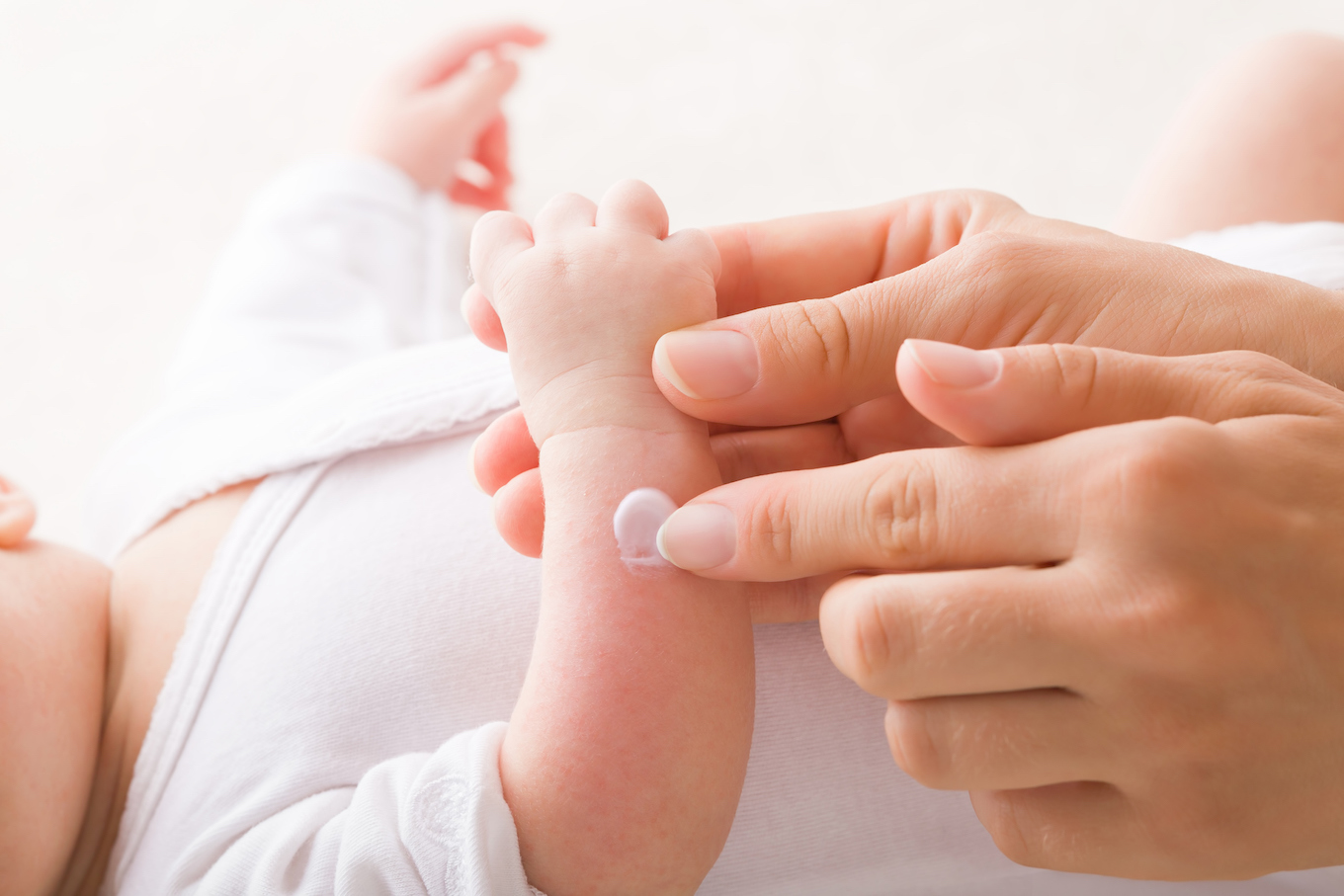 Young adult mother finger applying white medical ointment on newborn arm. Red rash on skin. Allergy from milk formula or mother milk. Care about baby body. Closeup. Side view.