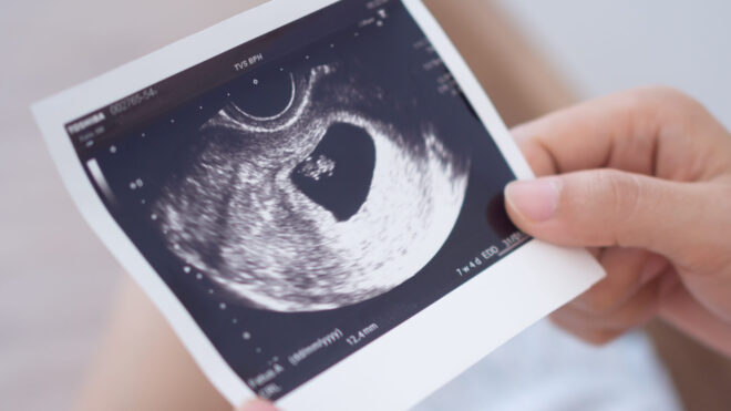 ultrasound