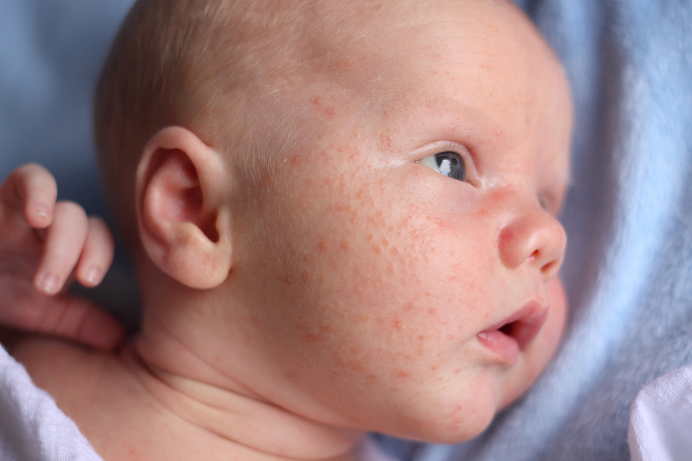 skin rash on kids