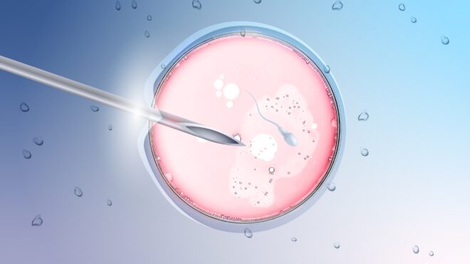IVF