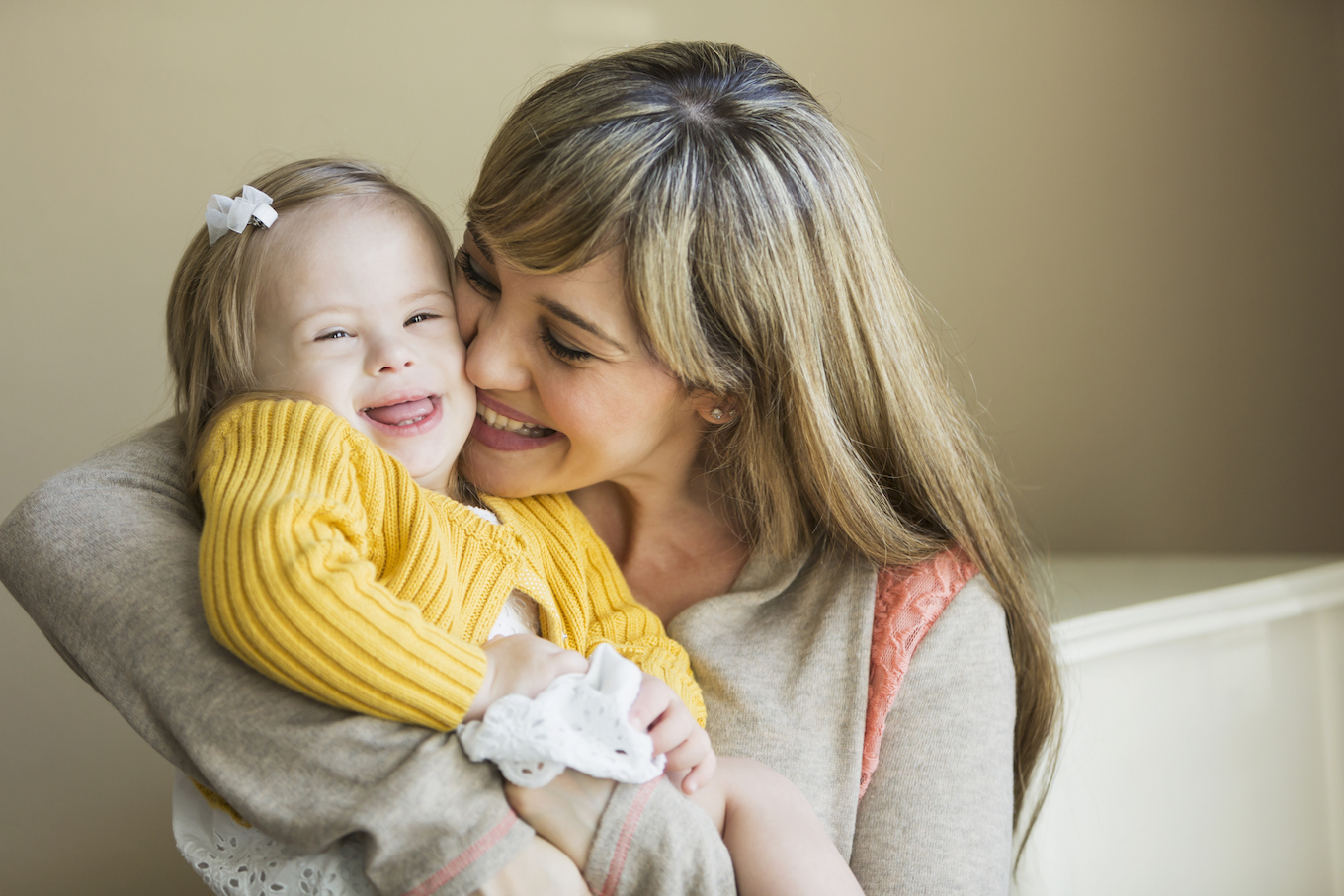 Mother and daughter with down syndrome