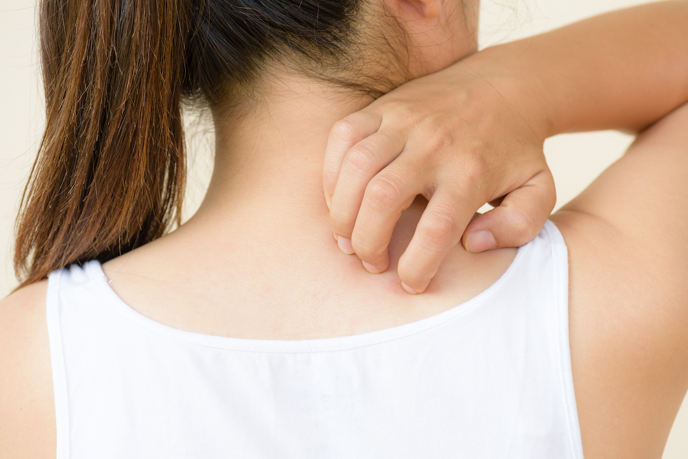 skin rash on kids