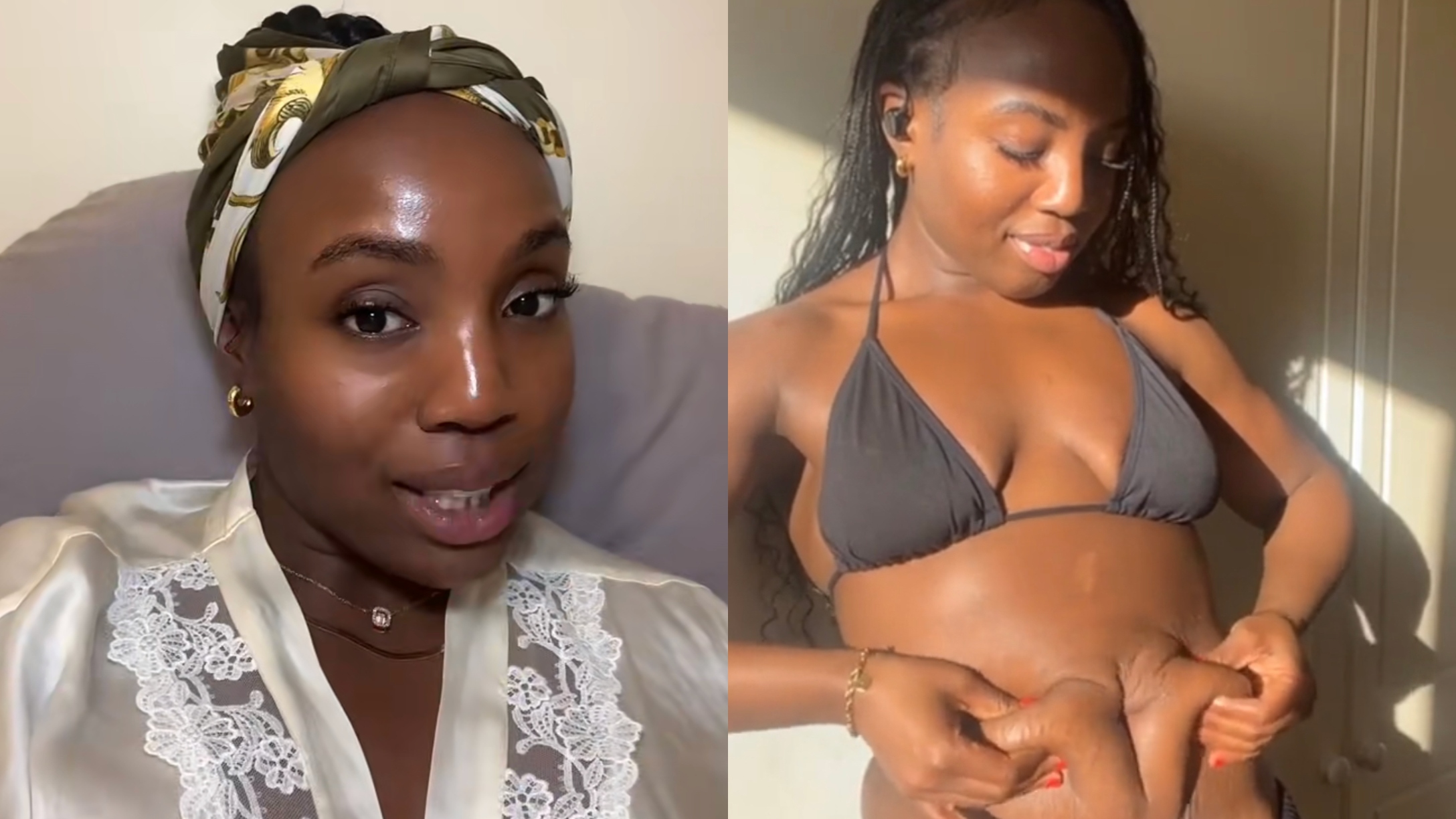 mommy makeover disappointment