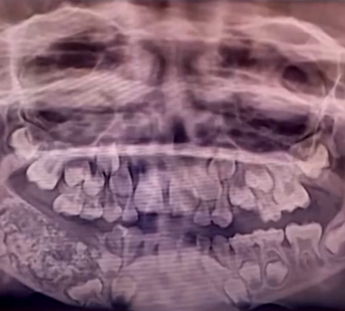 more-than-500-teeth.png