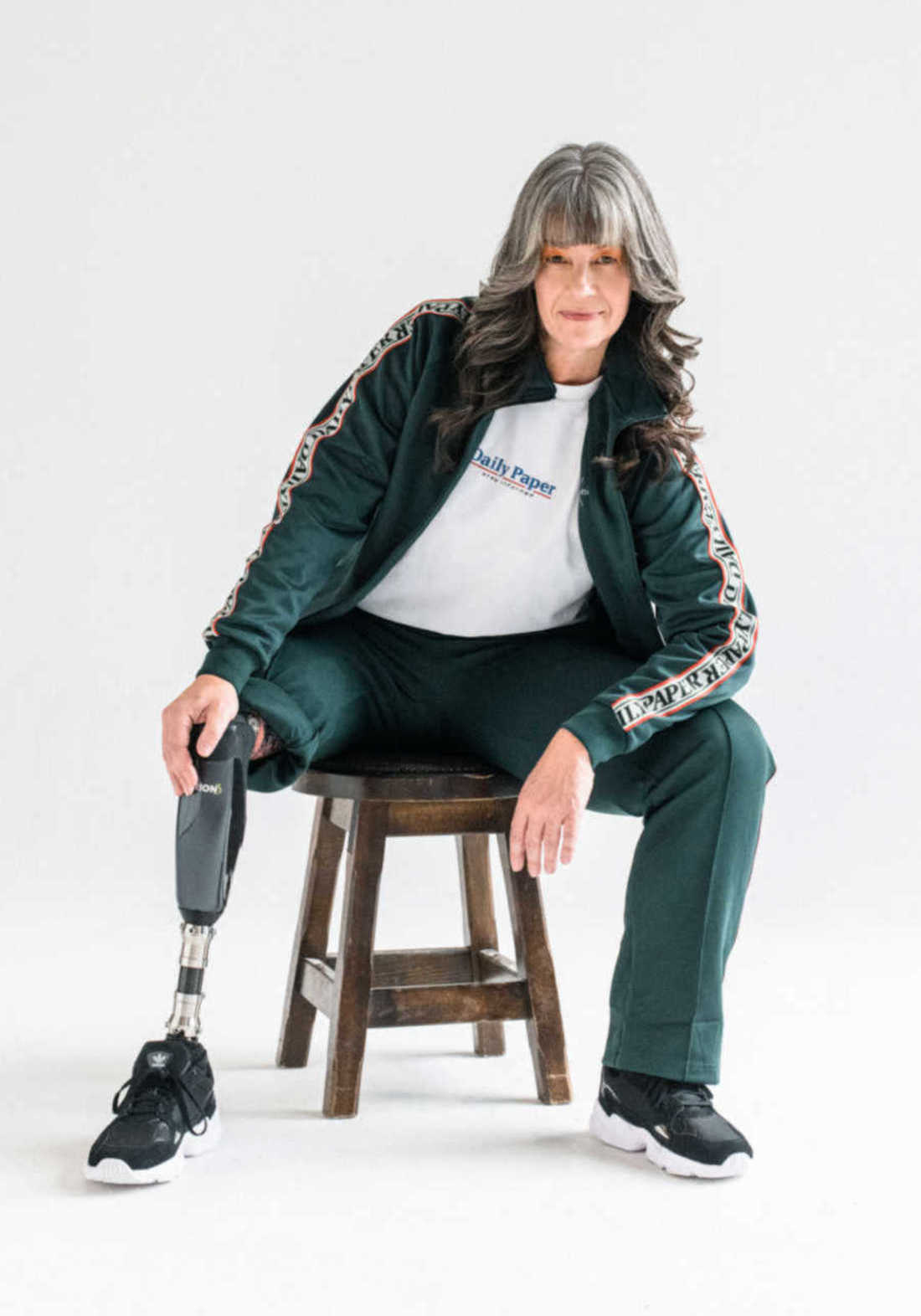 nancy_harris_limb_difference_advocate_strength_9-900x1272-1.jpeg