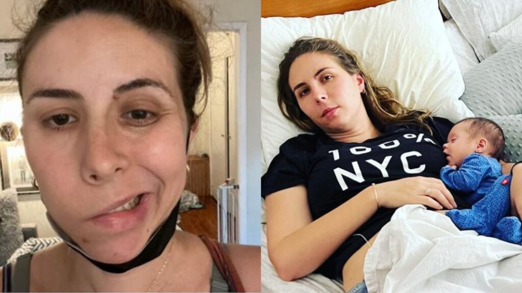 Twin Mom Notices 'Facial Paralysis' Weeks Before Giving Birth & Gets