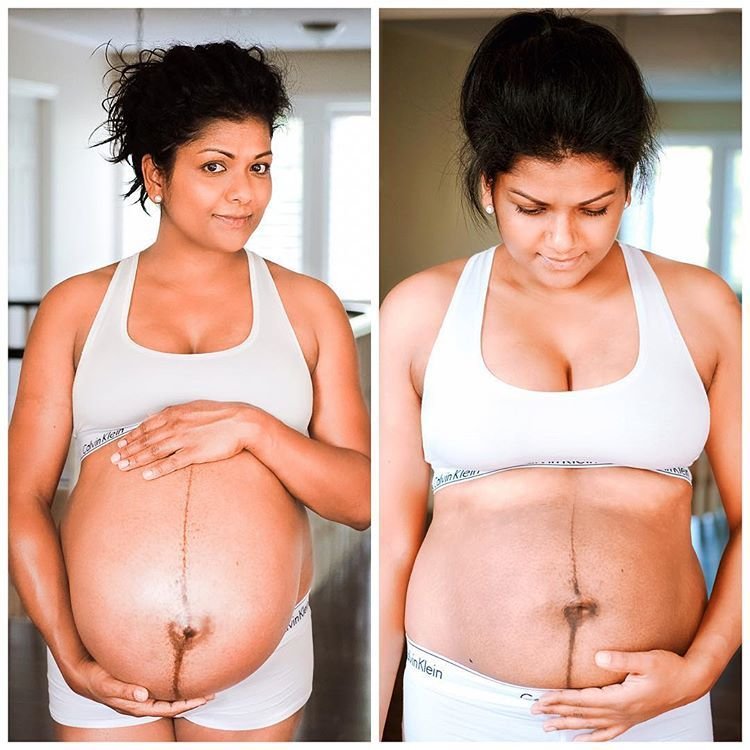 before and after pregnancy
