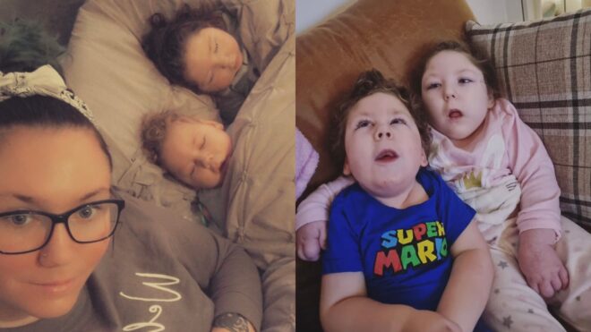 kids lissencephaly and microcephaly