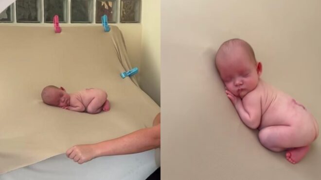 Spina Bifida newborn photo shoot