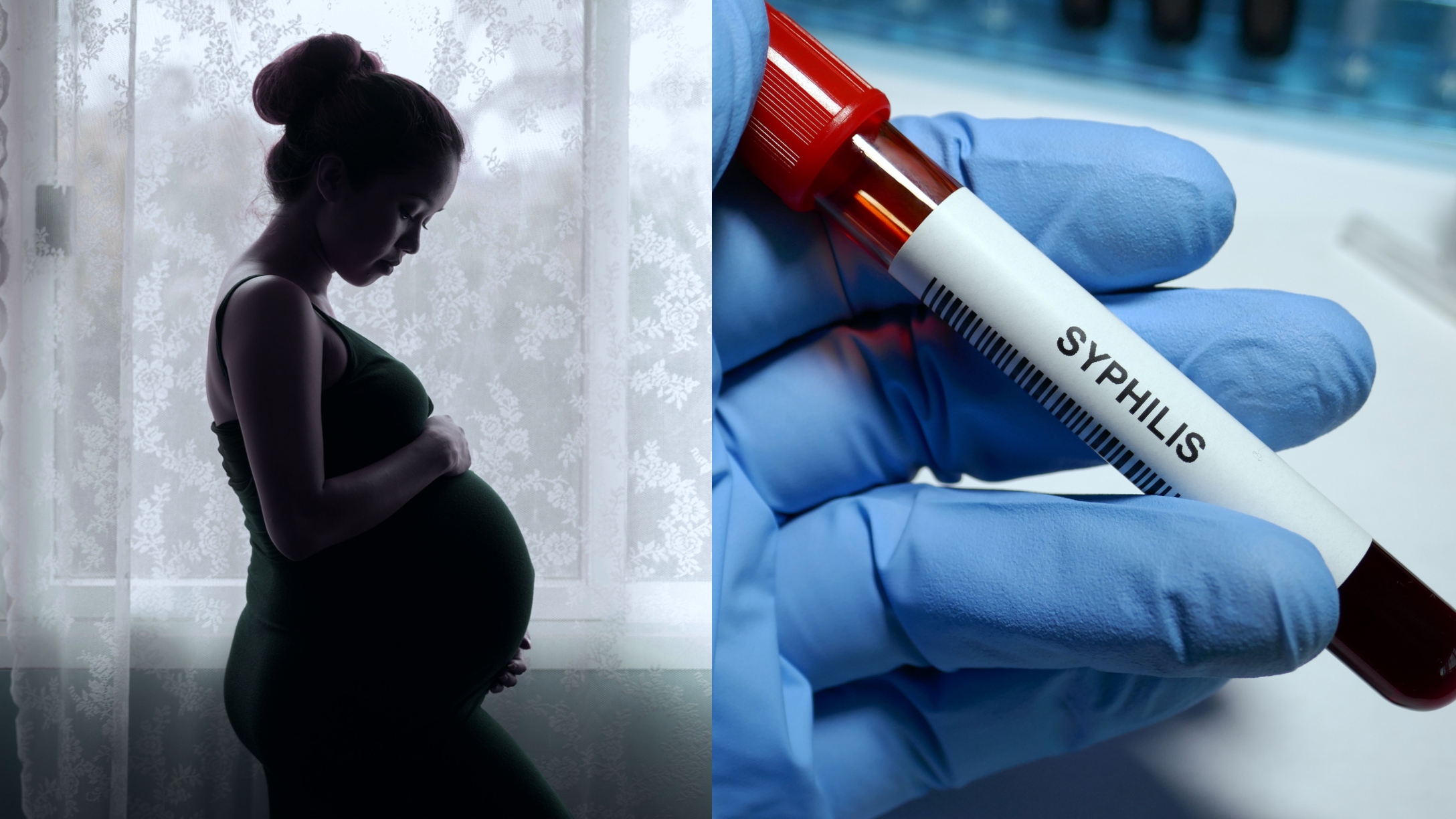 syphilis outbreak houston pregnant women