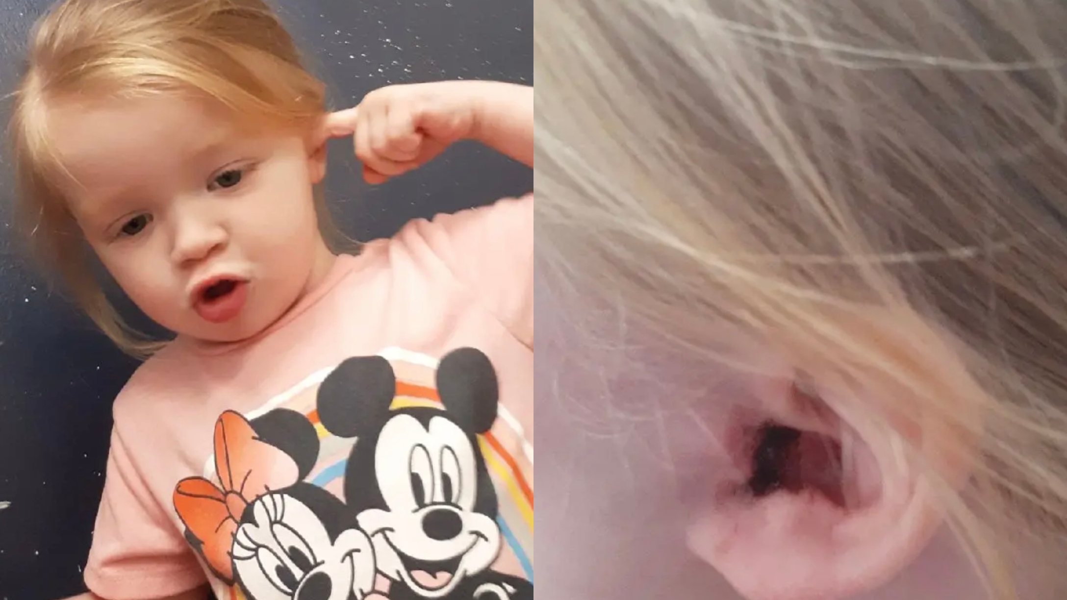 Ticks in ear