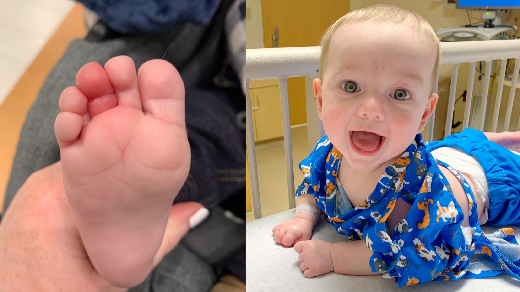 toe