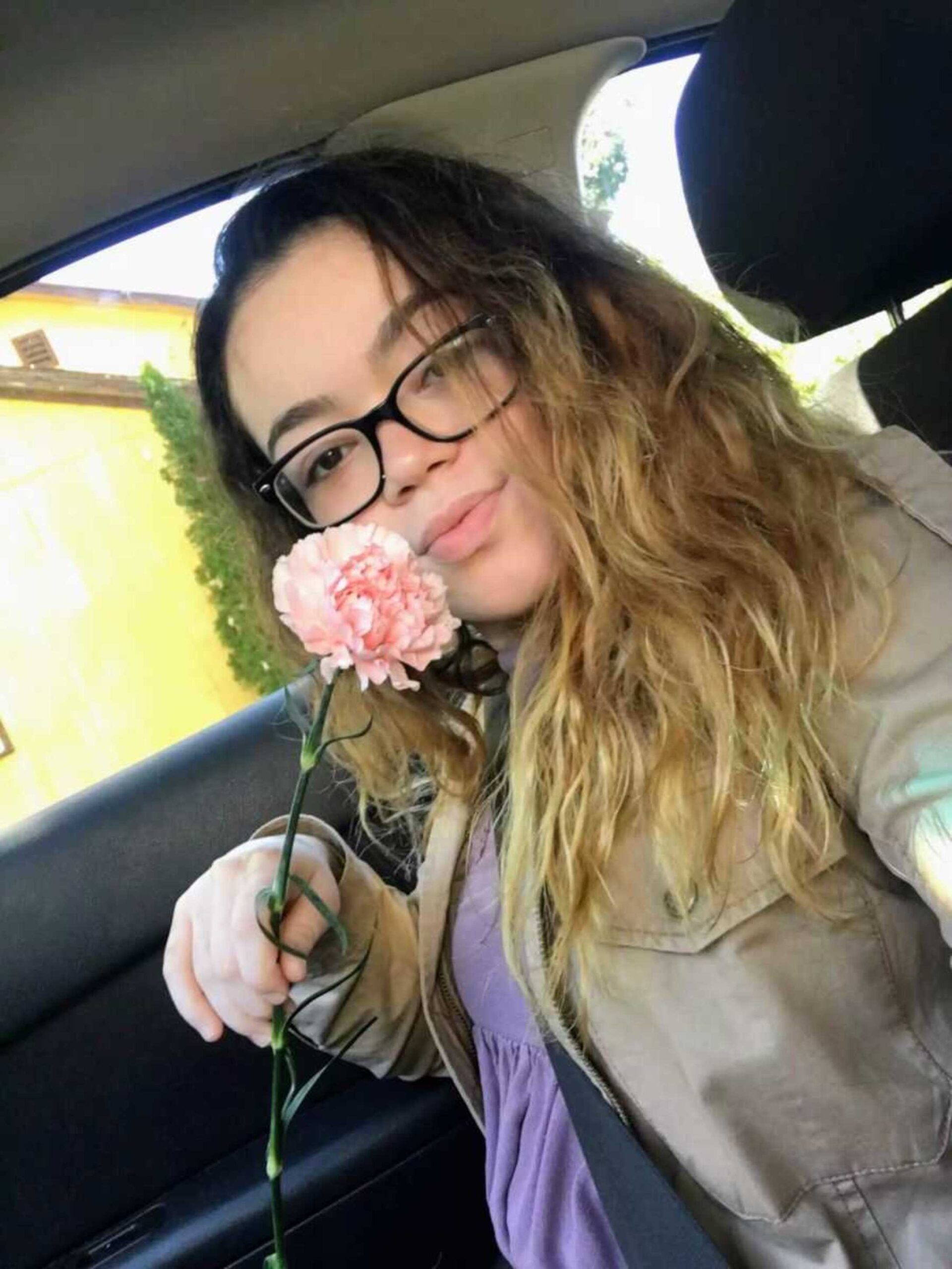 vitiligo-girl-with-rose-900x1200-1.jpeg