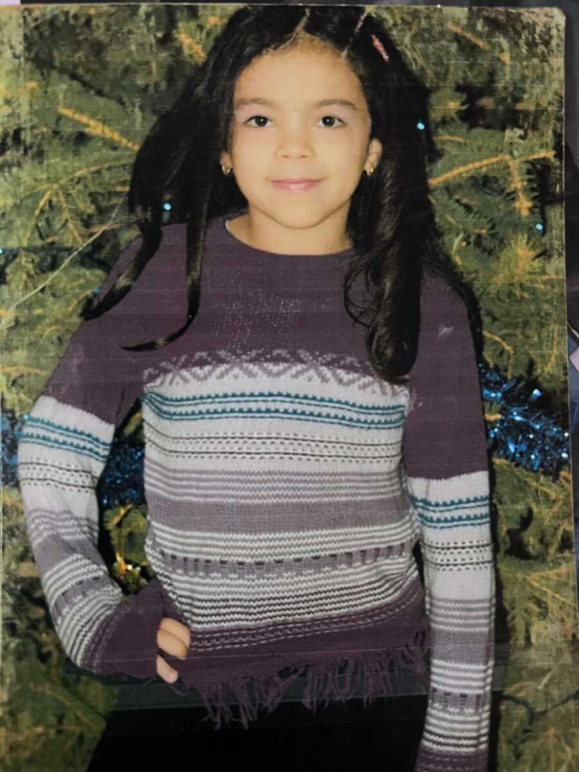 vitiligo-girl-young-sweater-900x1200-1.jpeg