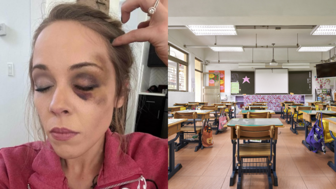 side by side of Madeline Cardoza and her black eye and a empty classroom