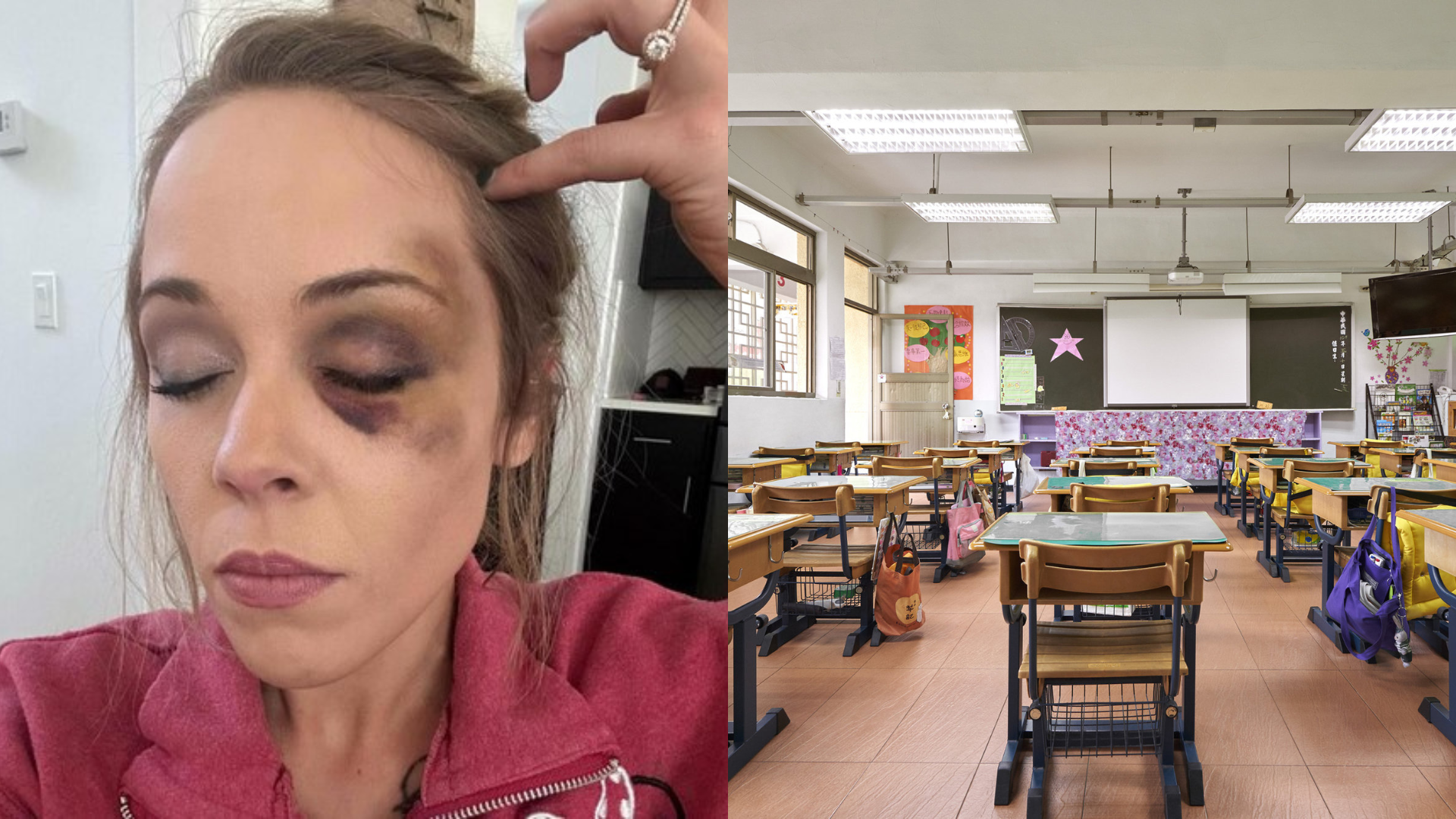 side by side of Madeline Cardoza and her black eye and a empty classroom