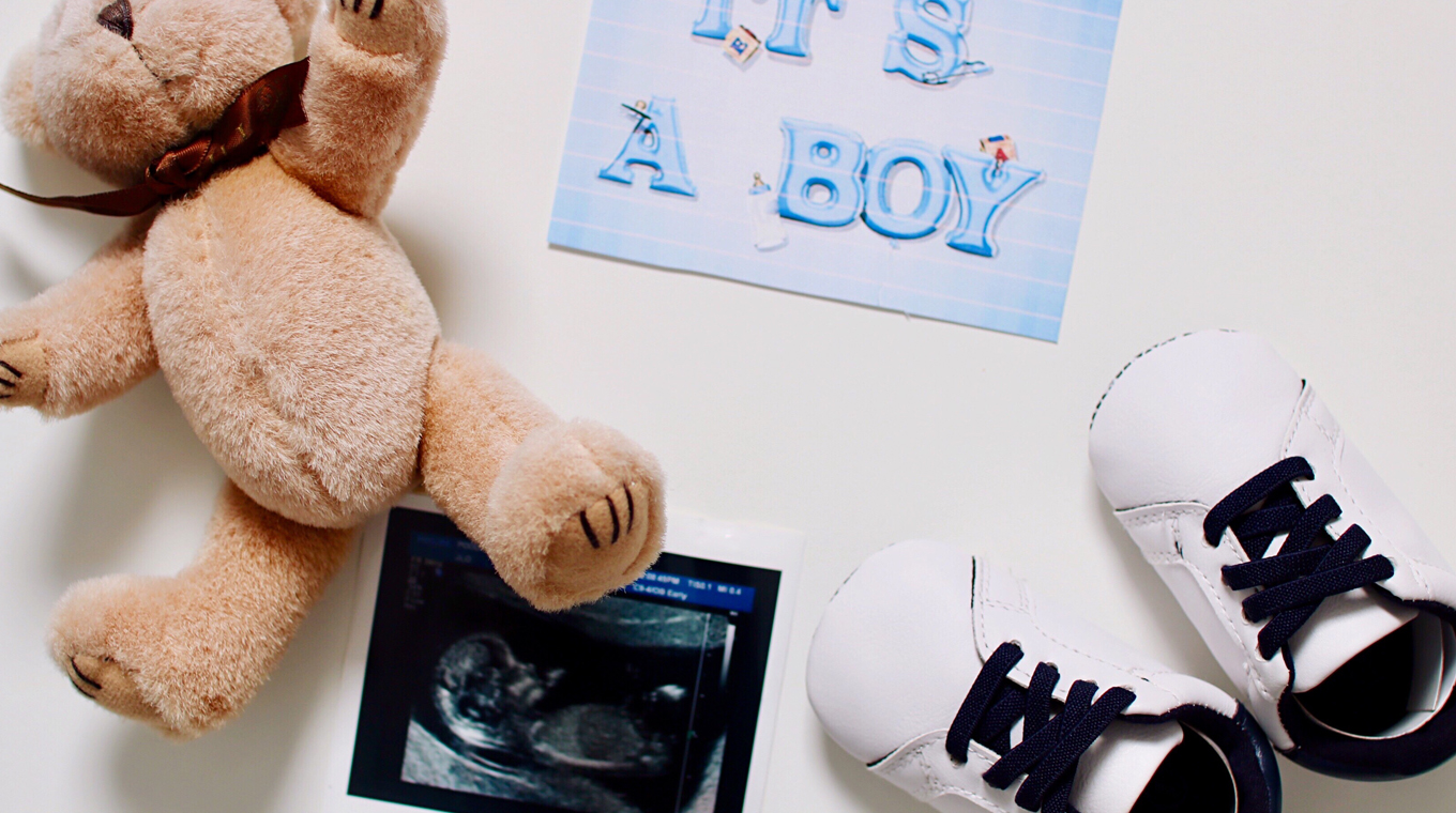 3d-ultrasound-3
