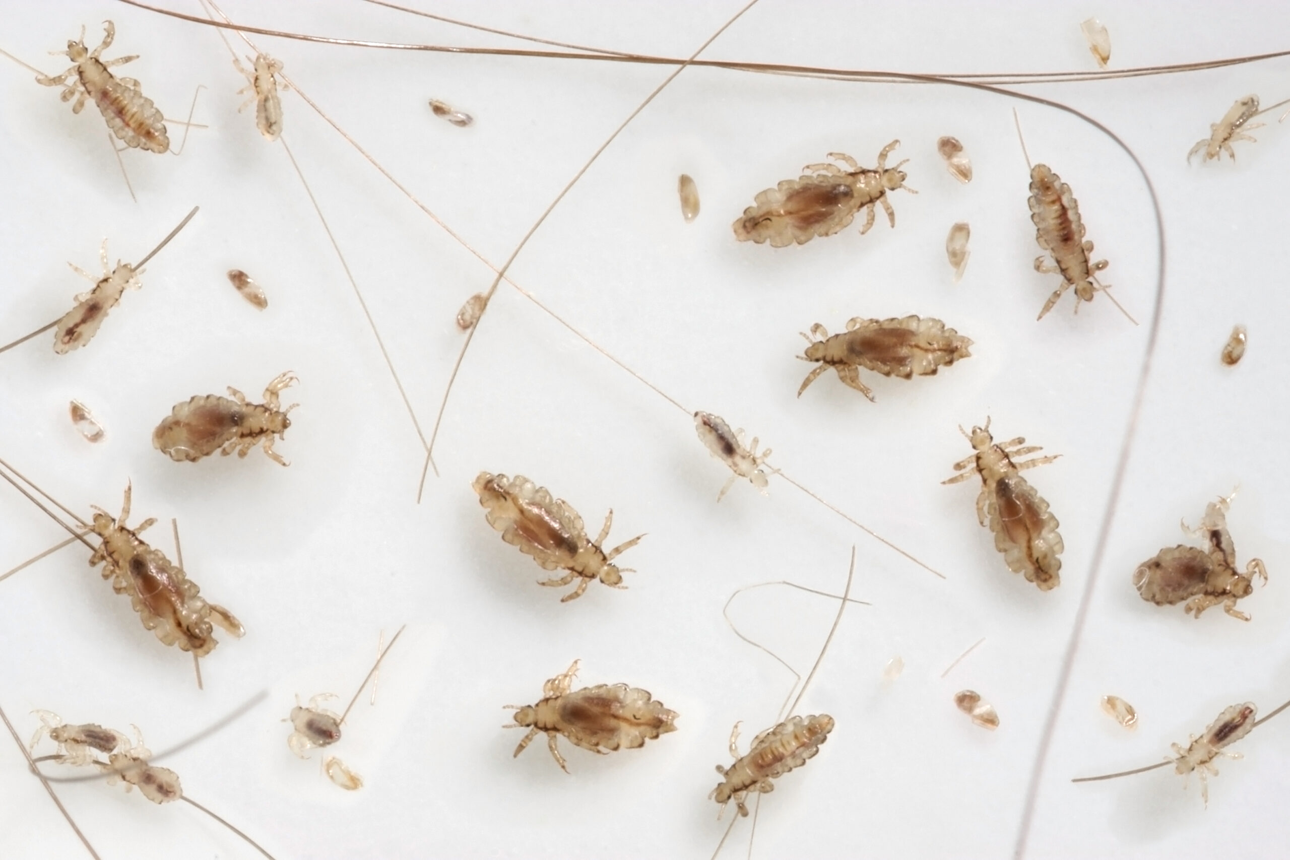 lice